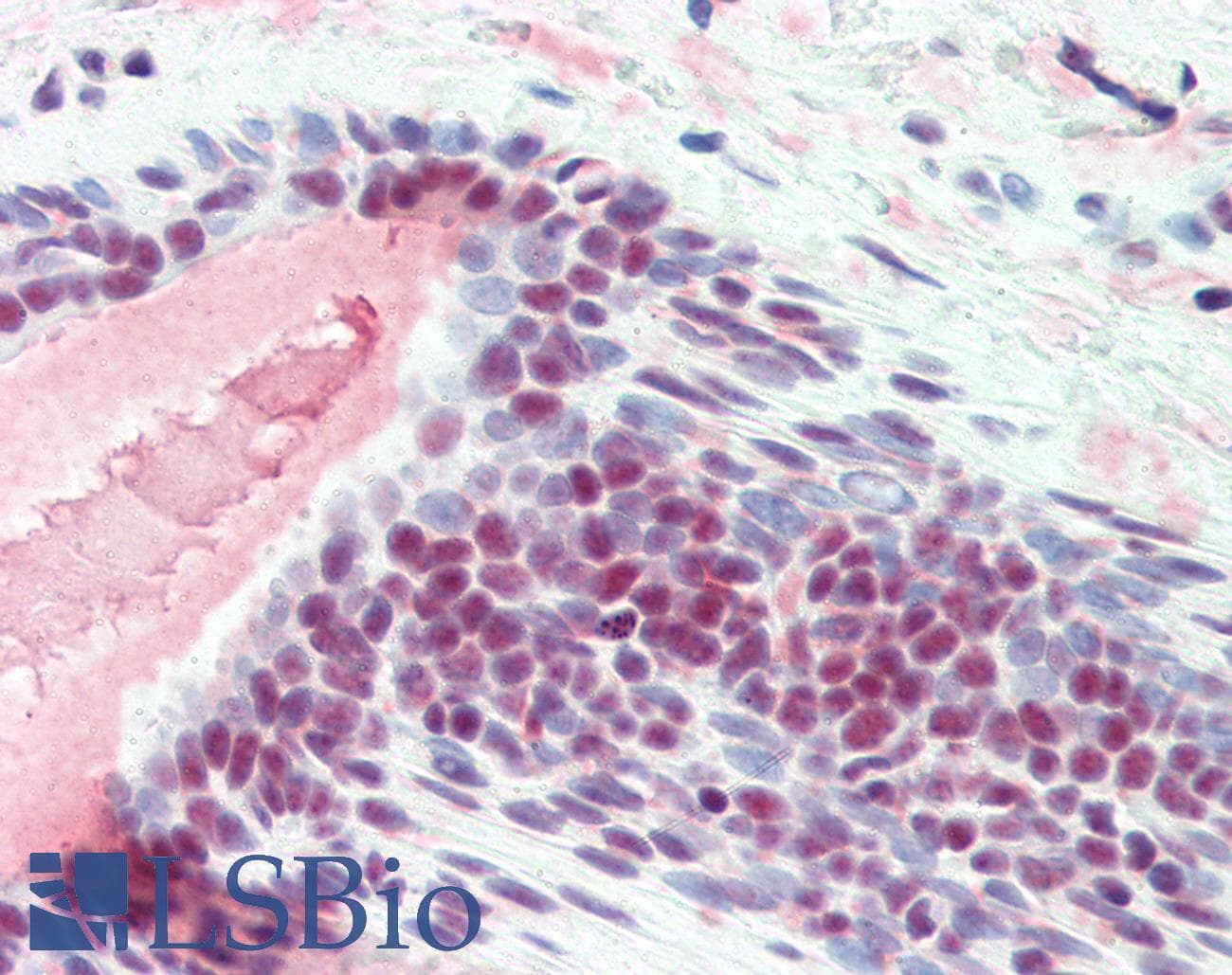 IHC-plus™ Monoclonal Mouse anti-Human SRSF1 / SF2 Antibody (N-Terminus, IHC, IF, WB)