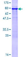Human PSMD4 / RPN10 Protein (Recombinant GST)