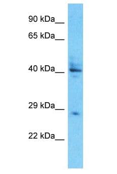 UTY Antibody (aa369-418)