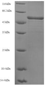 Human ATP2A2 / SERCA2 Protein (Recombinant 6His, N-terminus)