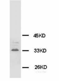 SYP / Synaptophysin Antibody (clone Syn-58, Magnetic beads)