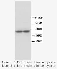 TPH1 / Tryptophan Hydroxylase Antibody (clone Try-63)