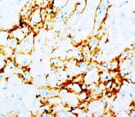 Monoclonal Mouse anti-Human TNC / Tenascin C Antibody (clone T20, IHC, WB)