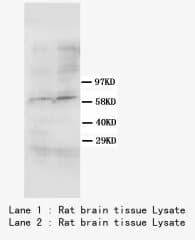 Monoclonal Mouse anti-Human SMAD4 Antibody (clone IMD-89, WB)