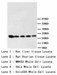 Monoclonal Mouse Phosphoserine Antibody (clone PS-53, WB)