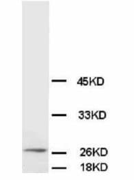 BCL2 / Bcl-2 Antibody (aa41-54, clone BL-2, Magnetic beads)