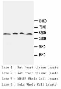 Monoclonal Mouse anti-Human CTSD / Cathepsin D Antibody (clone CP-D13, IHC, WB)