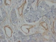 Monoclonal Mouse anti-Human Collagen IV Antibody (clone Col-30, Sepharose)