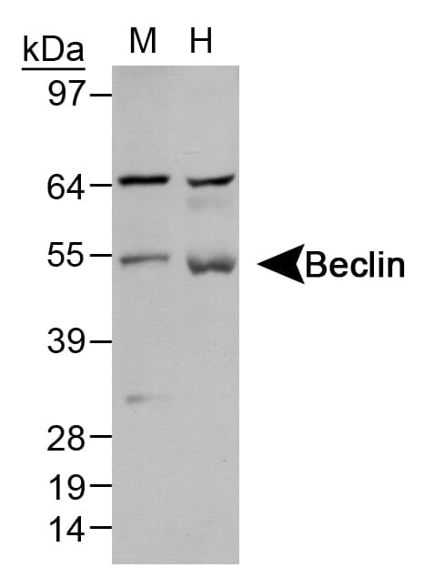 Polyclonal Rabbit anti-Human BECN1 / Beclin-1 Antibody (WB)