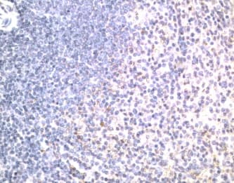 Polyclonal Goat anti-Human TNFRSF10B / Killer / DR5 Antibody (Extracellular Domain, IHC, WB)