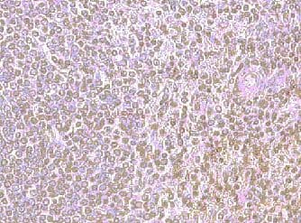 Polyclonal Goat anti-Human CXCR4 Antibody (aa17-42, IHC, WB)