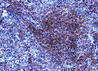 TLR9 Antibody (aa205-235)