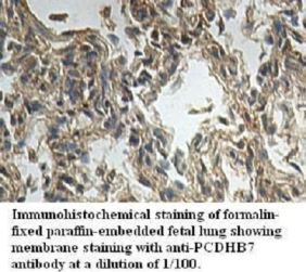 PCDHB7 Antibody (aa188-456)