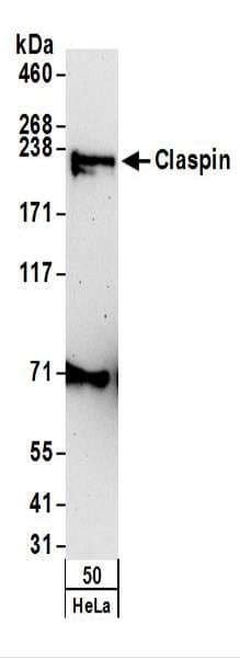 Polyclonal Rabbit anti-Human CLSPN / Claspin Antibody (aa725-775, IHC, WB)