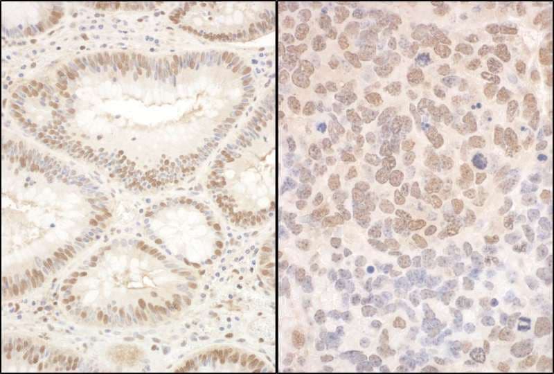 Polyclonal Rabbit anti-Human PQBP1 Antibody (aa150-200, IHC, WB)