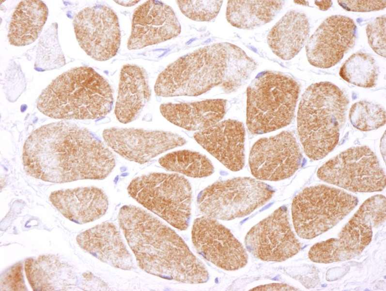 Polyclonal Rabbit anti-Human PRKAA1 / AMPK Alpha 1 Antibody (aa350-400, IHC)