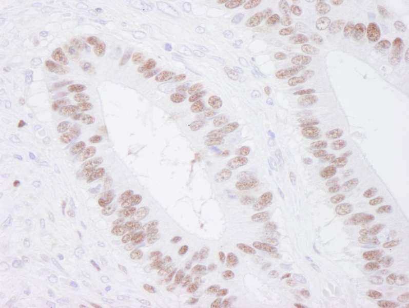 Polyclonal Rabbit anti-Human MCM3 Antibody (aa500-550, IHC)