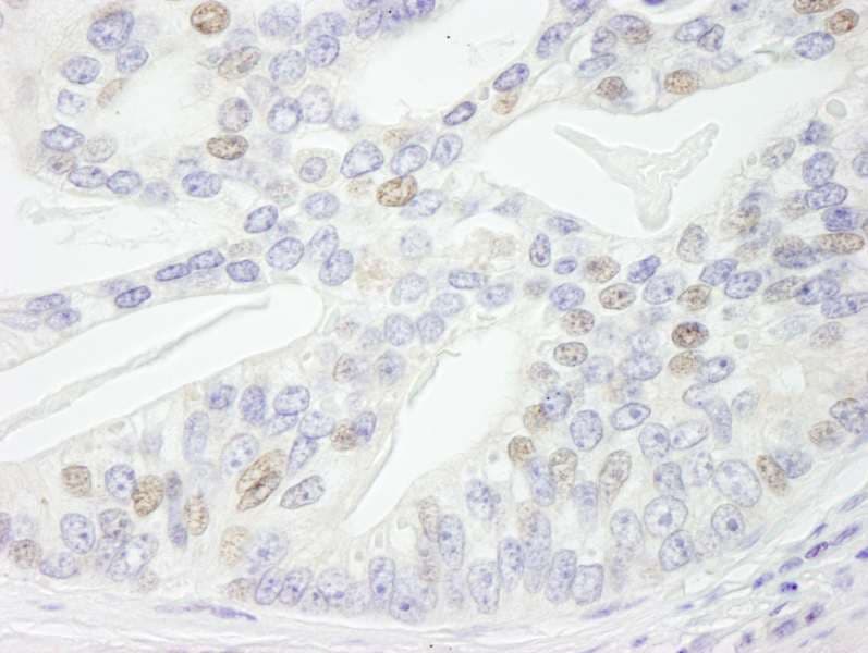 Polyclonal Rabbit anti-Human NBN / Nibrin Antibody (aa704-754, IHC, IF)