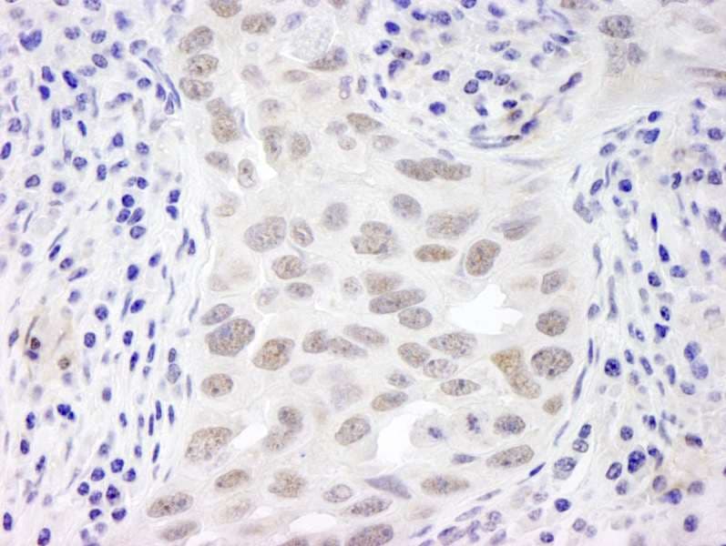 C11orf30 / EMSY Antibody (aa1250-C-term)