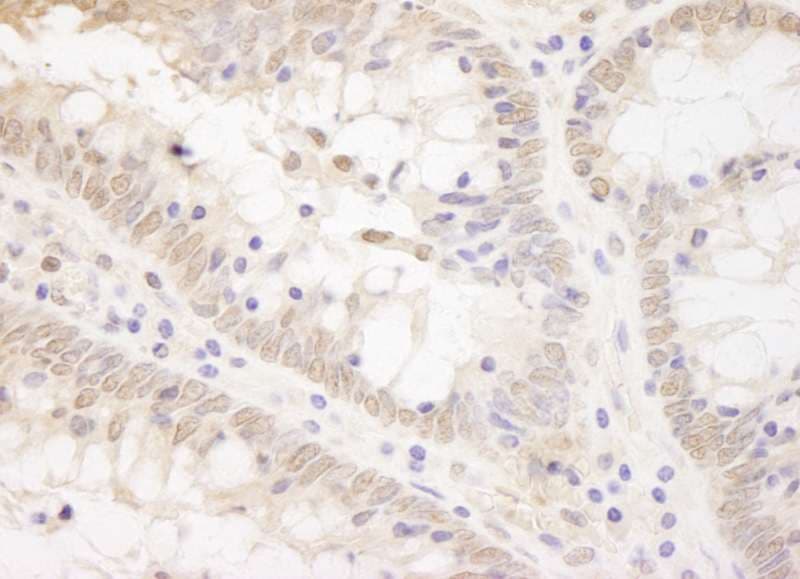 Polyclonal Rabbit anti-Human TCF12 / HEB Antibody (aa1-50, IHC)