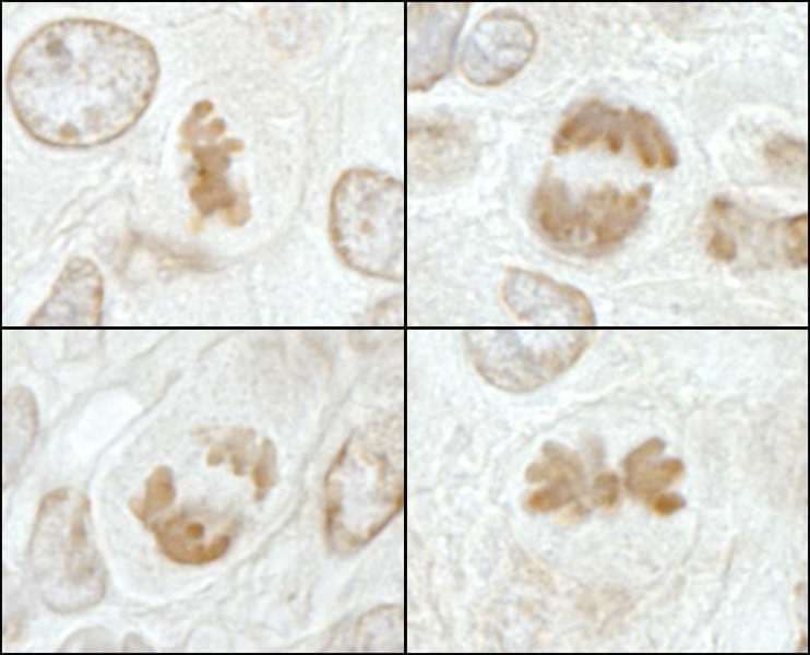 Polyclonal Rabbit anti-Mouse KIF2C / MCAK Antibody (aa50-100, IHC)
