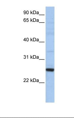 Polyclonal Rabbit anti-Human XBP1 Antibody (Biotin, aa38-87, WB)