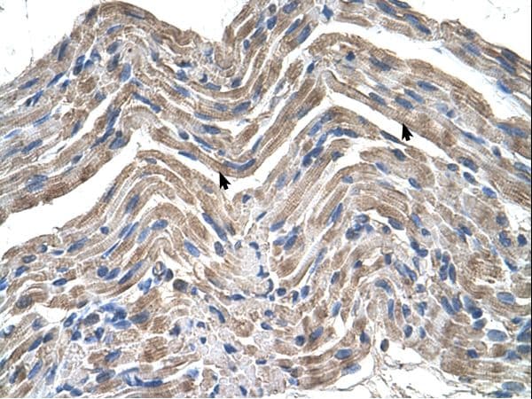 Polyclonal Rabbit anti-Human NPTN / SDR1 Antibody (aa201-250, IHC, WB)