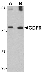 Polyclonal Rabbit anti-Human GDF6 / BMP13 Antibody (WB)