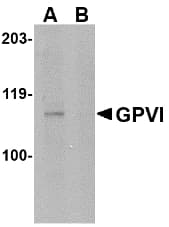 Polyclonal Rabbit anti-Human GP6 / GPVI Antibody (WB)