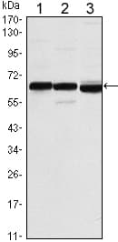 ER Alpha / Estrogen Receptor Antibody (clone 6B6)