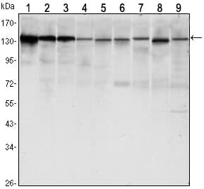 CDH1 / E Cadherin Antibody (clone 7H12)
