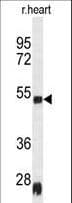 Monoclonal Mouse anti-Rat SERPINH1 / HSP47 Antibody (aa222-251, IHC, WB)