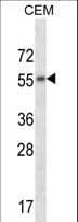 Polyclonal Rabbit anti-Human CHRM2 / M2 Antibody (aa336-364, WB)