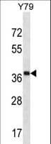 Polyclonal Rabbit anti-Human CLIP4 / RSNL2 Antibody (aa333-361, WB)