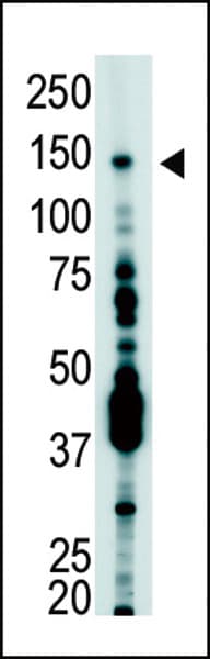 USP7 / HAUSP Antibody (aa1060-1090)