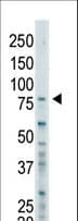 Polyclonal Rabbit anti-Human BAP1 Antibody (aa699-729, WB)