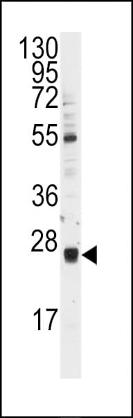 Polyclonal Rabbit anti-Human UBE2E3 Antibody (aa10-40, IHC, WB)