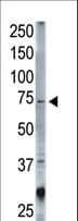 Polyclonal Rabbit anti-Human STAM1 / STAM Antibody (aa1-30, WB)