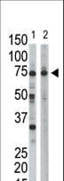 Polyclonal Rabbit anti-Human RPN1 / Ribophorin I Antibody (aa531-561, WB)