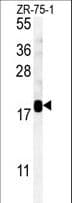 Polyclonal Rabbit anti-Human SDHAF1 Antibody (aa34-62, IHC, WB)