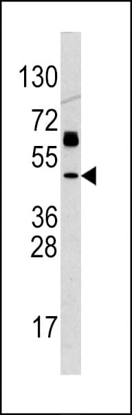 TP53 / p53 Antibody (aa354-385)