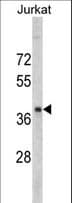 Polyclonal Rabbit anti-Human RRM2 Antibody (aa96-125, IHC, WB)