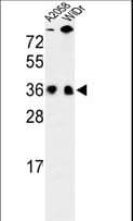 Polyclonal Rabbit anti-Human SRSF1 / SF2 Antibody (aa11-38, IHC, WB)