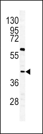 Polyclonal Rabbit anti-Human GHRHR Antibody (aa367-397, WB)