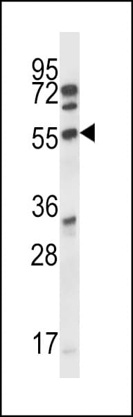 Polyclonal Rabbit anti-Human CDK15 / ALS2CR7 Antibody (aa49-78, WB)