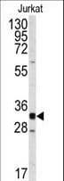 CDK2 Antibody (aa230-260)