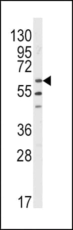 LYN Antibody (aa32-62)