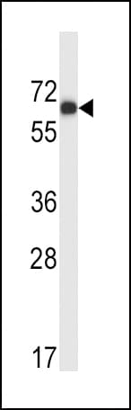 Polyclonal Rabbit anti-Human MATK Antibody (aa1-30, IHC, WB)