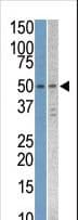 Polyclonal Rabbit anti-Human STK38L / NDR2 Antibody (aa408-437, WB)