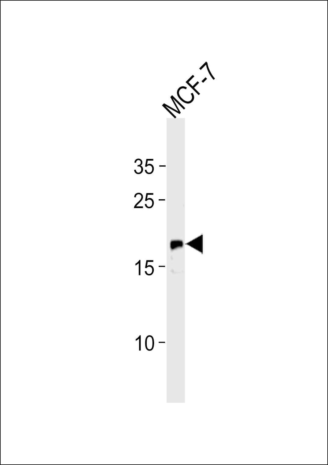 Polyclonal Rabbit anti-Human NRAS / N-ras Antibody (aa147-179, IHC, WB)